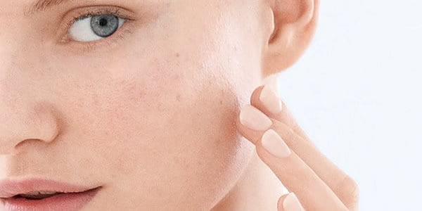 trattamento cicatrici viso